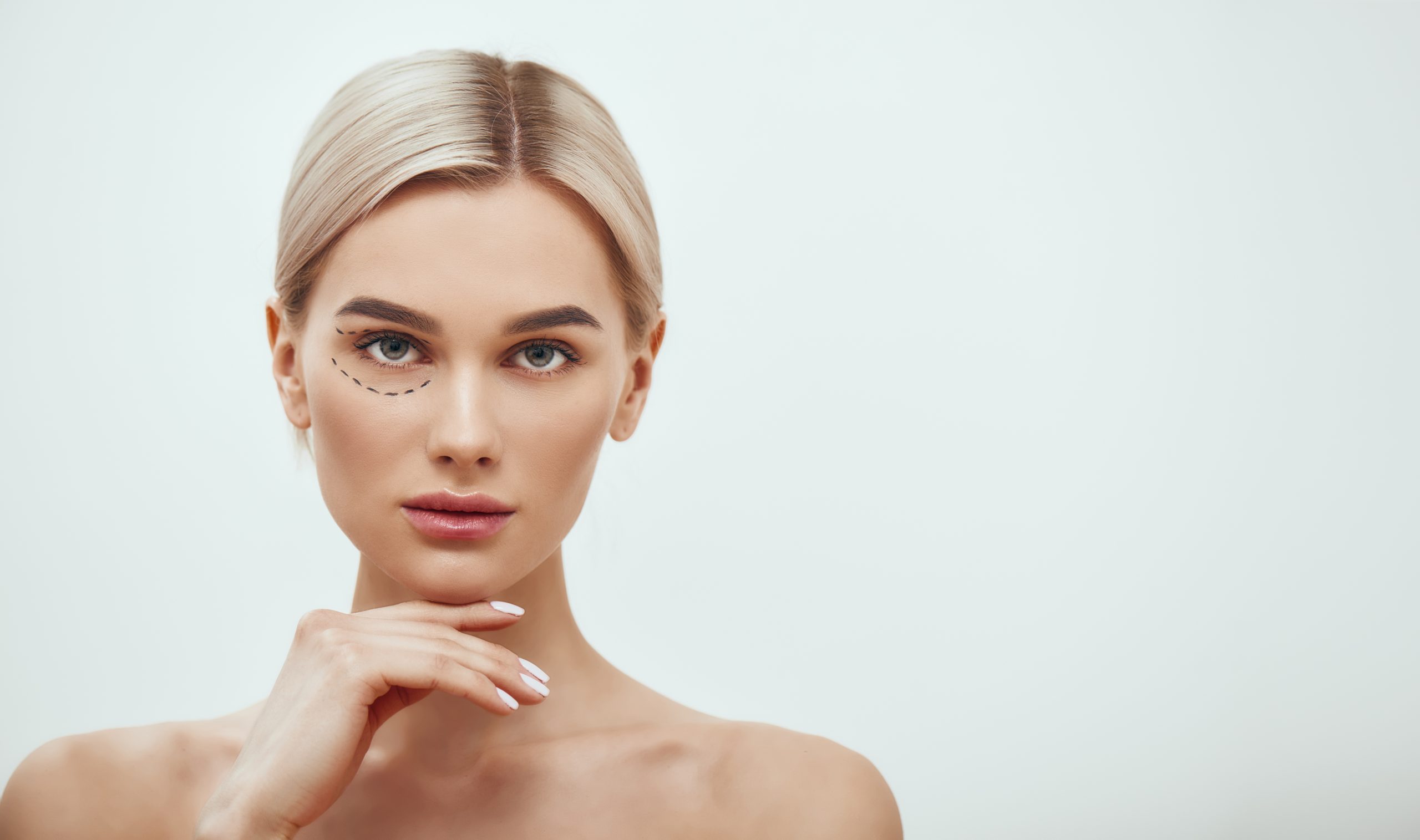 Blepharoplasty (Eyelid Lift)